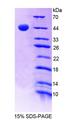 MGA / MAD5 Protein - Recombinant MAX Gene Associated Protein By SDS-PAGE