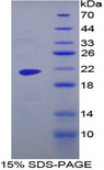 MGAM / Maltase-Glucoamylase Protein - Recombinant Maltase Glucoamylase, Intestinal By SDS-PAGE