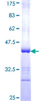 MGAT / GLYT1 Protein - 12.5% SDS-PAGE Stained with Coomassie Blue.