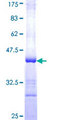 MGAT / GLYT1 Protein - 12.5% SDS-PAGE Stained with Coomassie Blue.