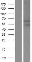 MGAT2 Protein - Western validation with an anti-DDK antibody * L: Control HEK293 lysate R: Over-expression lysate