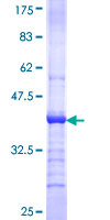 MGAT4A Protein - 12.5% SDS-PAGE Stained with Coomassie Blue.