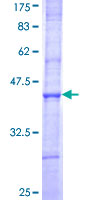 MGAT4B Protein - 12.5% SDS-PAGE Stained with Coomassie Blue.