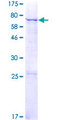 MGAT5B Protein - 12.5% SDS-PAGE of human MGAT5B stained with Coomassie Blue
