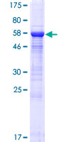 MGC11296 / BRMS1L Protein - 12.5% SDS-PAGE of human BRMS1L stained with Coomassie Blue