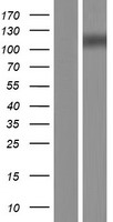MGEA5 Protein - Western validation with an anti-DDK antibody * L: Control HEK293 lysate R: Over-expression lysate