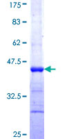 MGEA5 Protein - 12.5% SDS-PAGE Stained with Coomassie Blue.