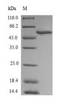 MGLL / Monoacylglycerol Lipase Protein - (Tris-Glycine gel) Discontinuous SDS-PAGE (reduced) with 5% enrichment gel and 15% separation gel.