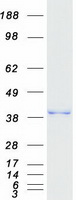 MGME1 / C20orf72 Protein - Purified recombinant protein MGME1 was analyzed by SDS-PAGE gel and Coomassie Blue Staining