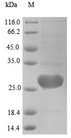 MGMT Protein - (Tris-Glycine gel) Discontinuous SDS-PAGE (reduced) with 5% enrichment gel and 15% separation gel.