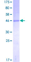 MGMT Protein - 12.5% SDS-PAGE of human MGMT stained with Coomassie Blue