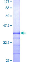 MGMT Protein - 12.5% SDS-PAGE Stained with Coomassie Blue.