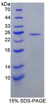MGMT Protein - Recombinant  O-6-Methylguanine DNA Methyltransferase By SDS-PAGE