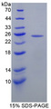 MGMT Protein - Recombinant  O-6-Methylguanine DNA Methyltransferase By SDS-PAGE