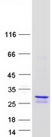 MGMT Protein - Purified recombinant protein MGMT was analyzed by SDS-PAGE gel and Coomassie Blue Staining