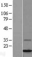 MGP / Matrix Gla-Protein Protein - Western validation with an anti-DDK antibody * L: Control HEK293 lysate R: Over-expression lysate