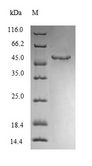 MGP / Matrix Gla-Protein Protein - (Tris-Glycine gel) Discontinuous SDS-PAGE (reduced) with 5% enrichment gel and 15% separation gel.