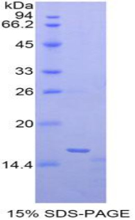 MGP / Matrix Gla-Protein Protein - Recombinant Matrix Gla Protein By SDS-PAGE