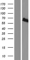 MGRN1 Protein - Western validation with an anti-DDK antibody * L: Control HEK293 lysate R: Over-expression lysate