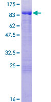 MGRN1 Protein - 12.5% SDS-PAGE of human MGRN1 stained with Coomassie Blue