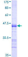 MGRN1 Protein - 12.5% SDS-PAGE Stained with Coomassie Blue.