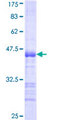 MGRN1 Protein - 12.5% SDS-PAGE Stained with Coomassie Blue.