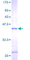 MGST1 Protein - 12.5% SDS-PAGE of human MGST1 stained with Coomassie Blue