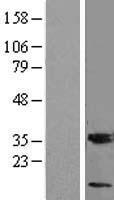 MGST3 Protein - Western validation with an anti-DDK antibody * L: Control HEK293 lysate R: Over-expression lysate