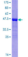 MIA40 / CHCHD4 Protein - 12.5% SDS-PAGE of human CHCHD4 stained with Coomassie Blue