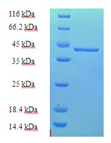 MIA40 / CHCHD4 Protein
