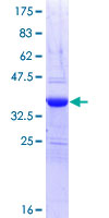 MIB1 Protein - 12.5% SDS-PAGE Stained with Coomassie Blue.