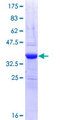 MIB1 Protein - 12.5% SDS-PAGE Stained with Coomassie Blue.