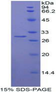 MIB1 Protein - Recombinant Mindbomb Homolog 1 By SDS-PAGE