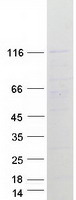 MIB1 Protein - Purified recombinant protein MIB1 was analyzed by SDS-PAGE gel and Coomassie Blue Staining
