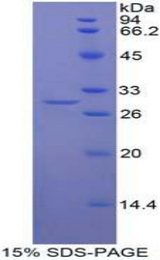 MIB2 Protein - Recombinant Mindbomb Homolog 2 By SDS-PAGE