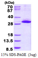 MIBP / ITGB1BP3 Protein