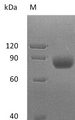 MICA Protein - (Tris-Glycine gel) Discontinuous SDS-PAGE (reduced) with 5% enrichment gel and 15% separation gel.