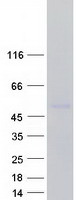 MICA Protein - Purified recombinant protein MICA was analyzed by SDS-PAGE gel and Coomassie Blue Staining