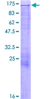 MICAL1 / MICAL Protein - 12.5% SDS-PAGE of human MICAL1 stained with Coomassie Blue
