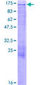 MICAL1 / MICAL Protein - 12.5% SDS-PAGE of human MICAL1 stained with Coomassie Blue