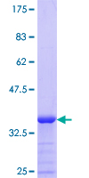 MICAL1 / MICAL Protein - 12.5% SDS-PAGE Stained with Coomassie Blue.