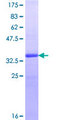MICAL2 Protein - 12.5% SDS-PAGE Stained with Coomassie Blue.