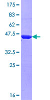 MICAL3 Protein - 12.5% SDS-PAGE Stained with Coomassie Blue.