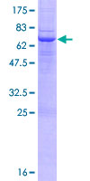 MICB Protein - 12.5% SDS-PAGE of human MICB stained with Coomassie Blue