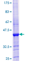 MICB Protein - 12.5% SDS-PAGE Stained with Coomassie Blue