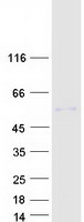 MICB Protein - Purified recombinant protein MICB was analyzed by SDS-PAGE gel and Coomassie Blue Staining
