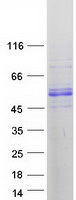 MICU1 / CBARA1 Protein - Purified recombinant protein MICU1 was analyzed by SDS-PAGE gel and Coomassie Blue Staining