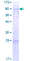 MICU3 / EFHA2 Protein - 12.5% SDS-PAGE of human EFHA2 stained with Coomassie Blue