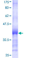 MID1 Protein - 12.5% SDS-PAGE Stained with Coomassie Blue