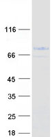 MID1 Protein - Purified recombinant protein MID1 was analyzed by SDS-PAGE gel and Coomassie Blue Staining